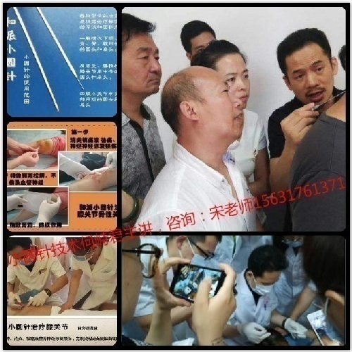 小圆针培训班—何峙君小圆针治疗颈腰椎病、膝关节等
